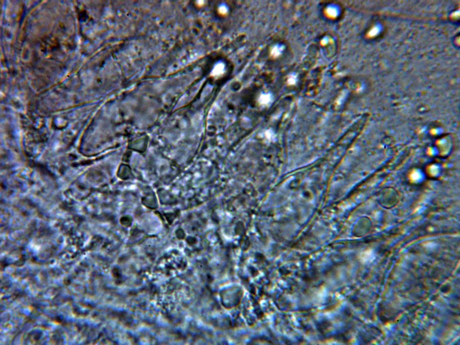 Microscopía de Mycena haematopus - 10 - Queilocistidios 2